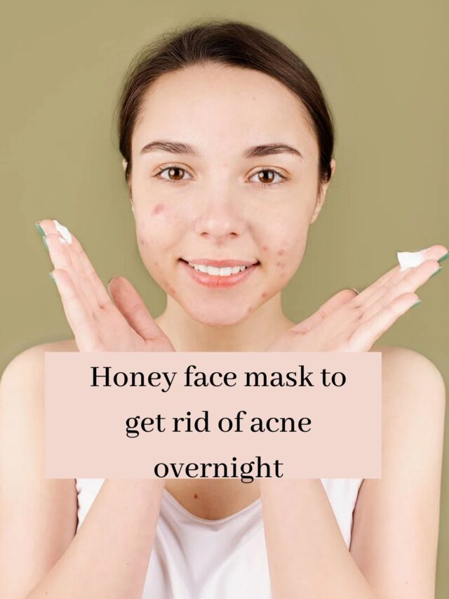 honey-face-mask-to-get-rid-of-acne-overnight-biggrow